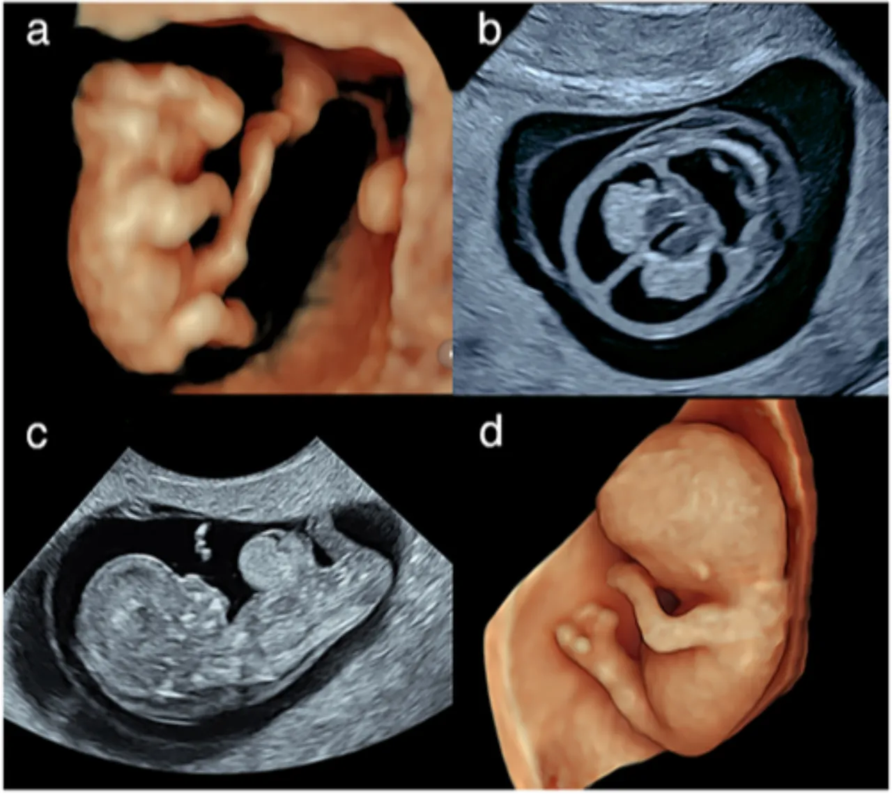 Balık adamı bıçakladı, dişten göz oldu! Dünyanın en sıra dışı vakaları açıklandı
