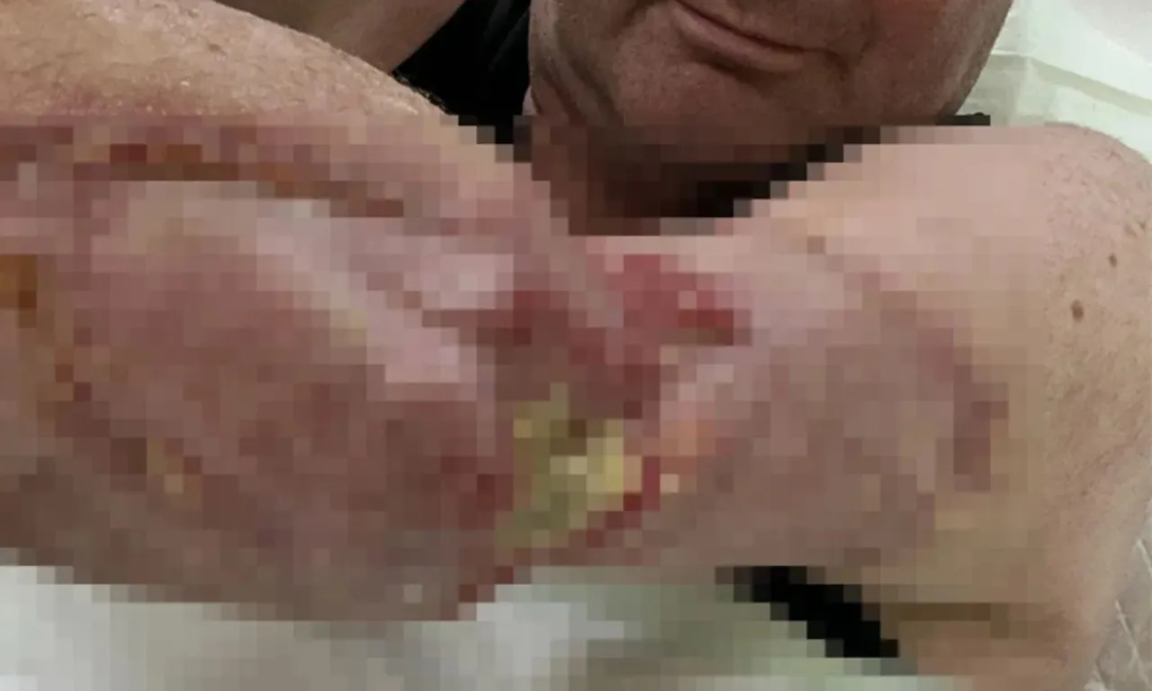 Her şey boğaz ağrısıyla başladı, hastalığı ‘ölümcül’ çıktı! Tam 25 ameliyat geçirdi