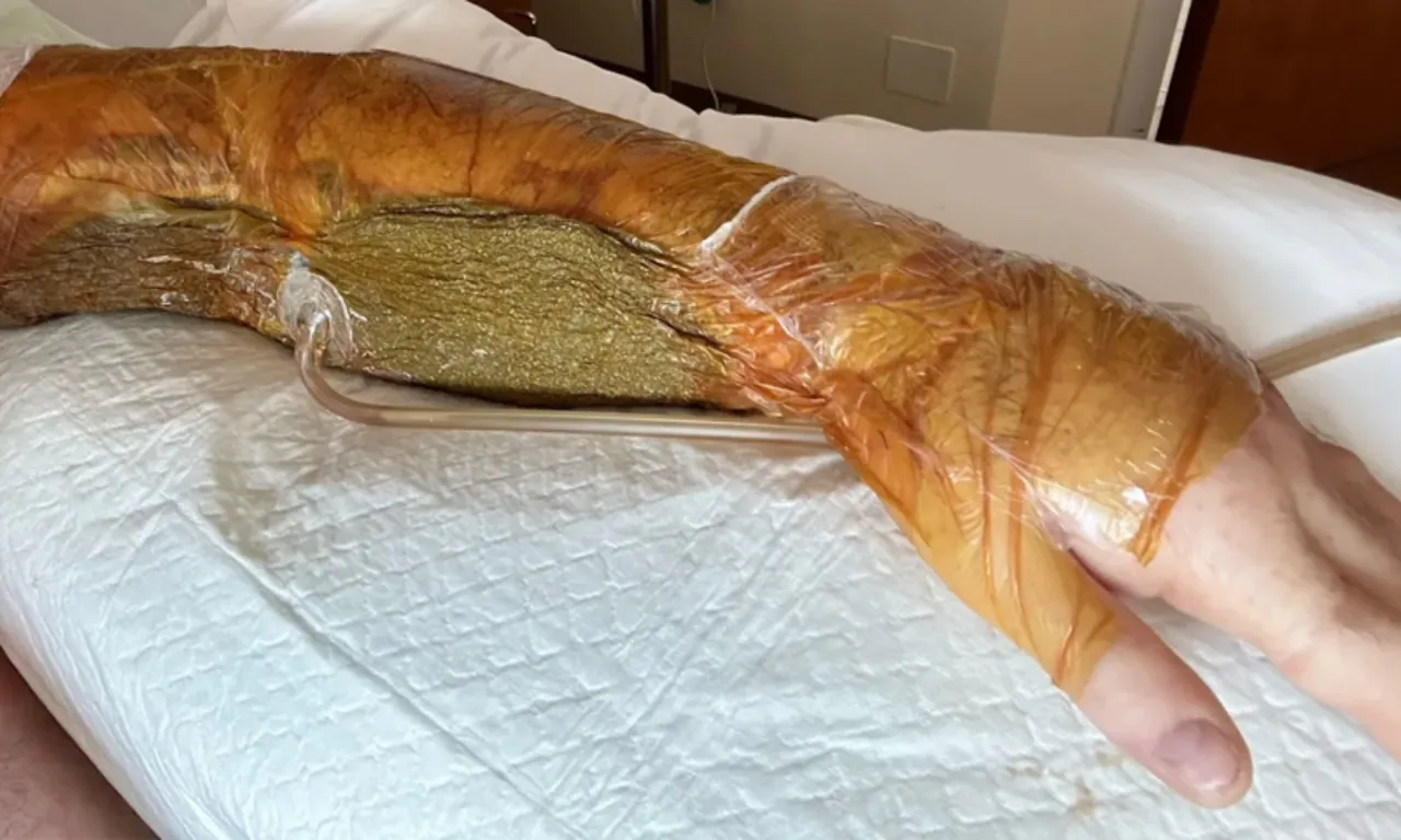 SPORDA SAKATLANDIĞINI DÜŞÜNDÜ ANCAK…