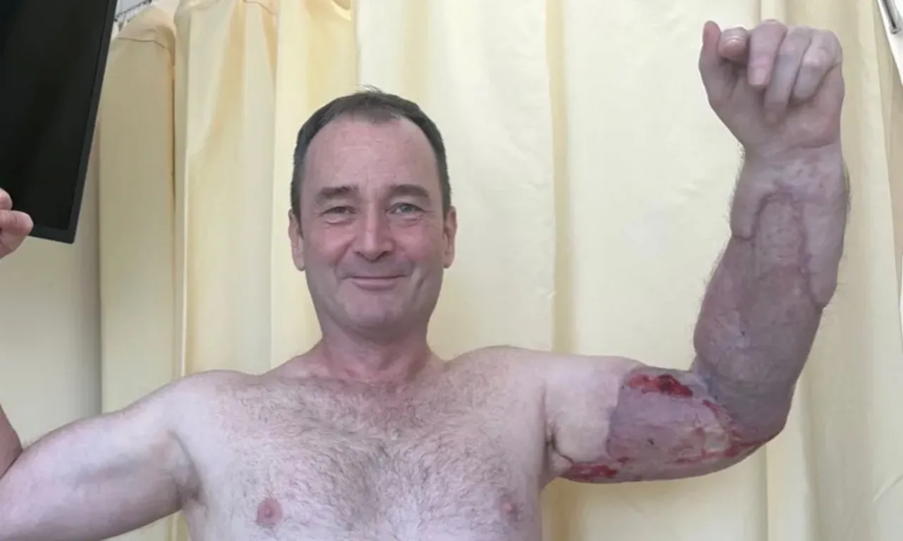 25 KEZ AMELİYAT OLDU