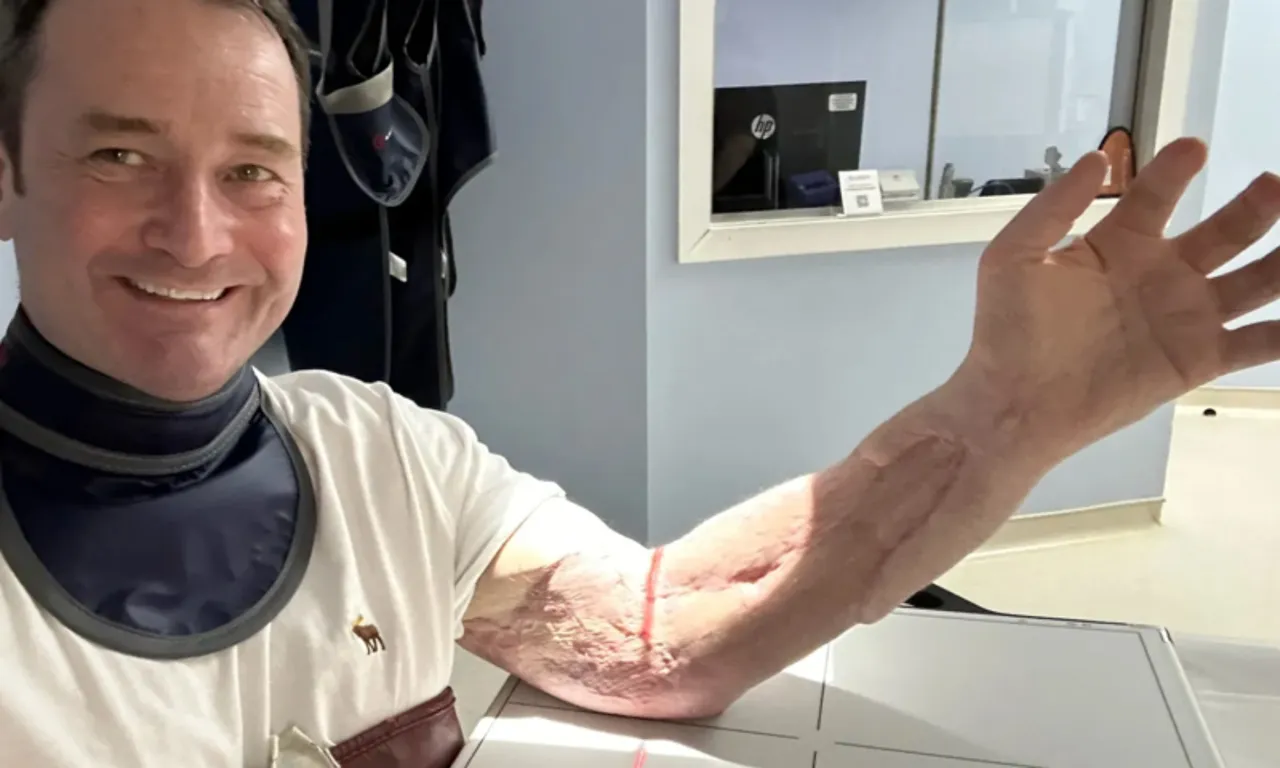 Her şey boğaz ağrısıyla başladı, hastalığı ‘ölümcül’ çıktı! Tam 25 ameliyat geçirdi