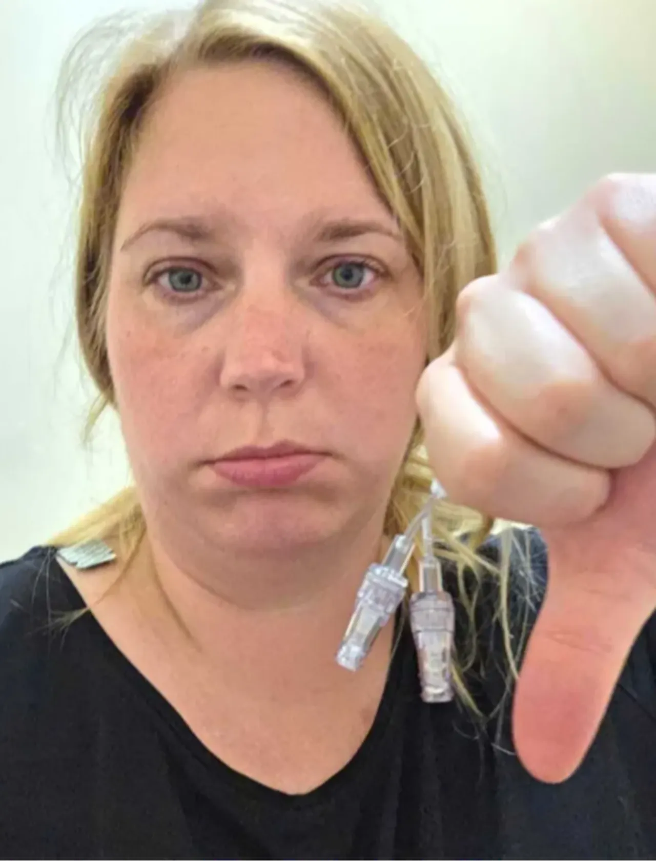 Sabah uyandı, kolunu kıpırdatamadı! Aldığı teşhisle hayatı değişti: Sanki taşa dönüşmüştüm