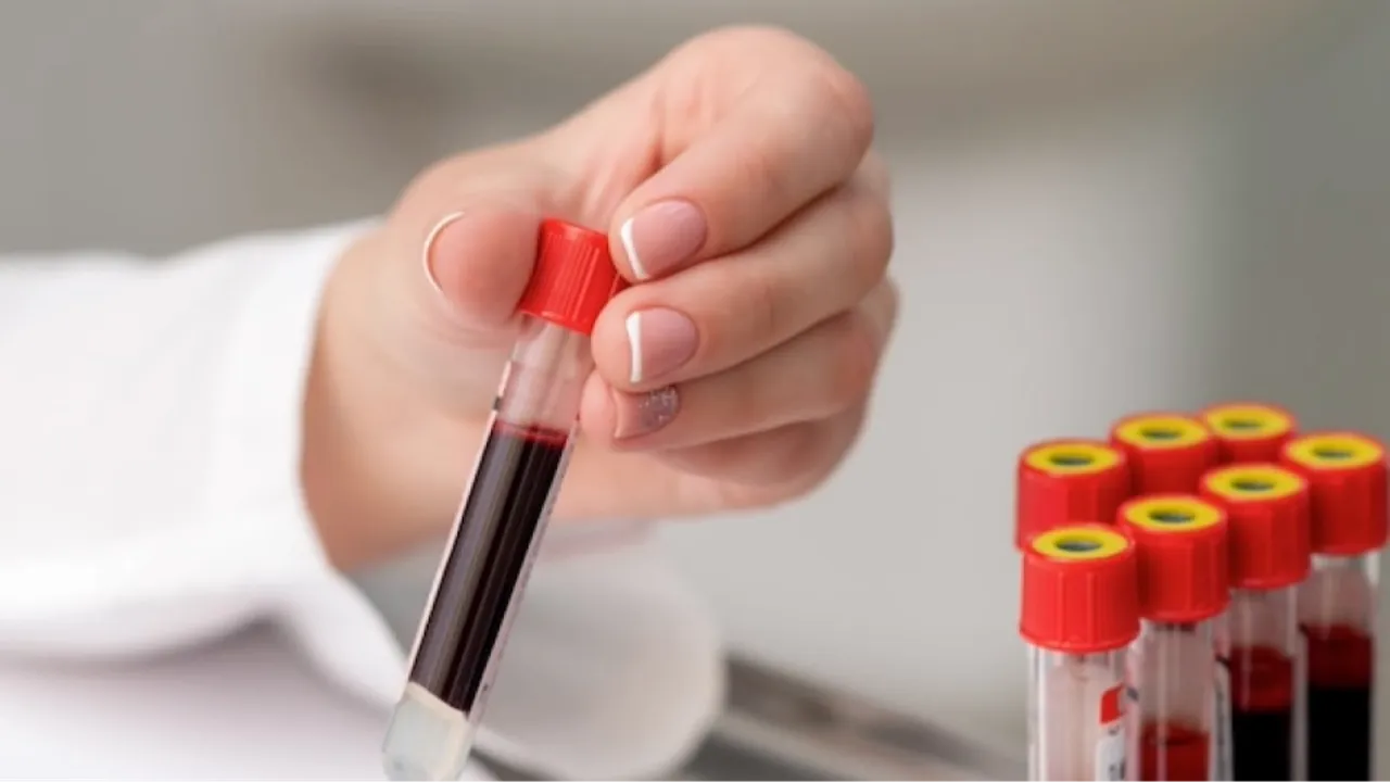 Sessiz tehlike! İlikteki gizli değişim lösemiyi yıllar önceden haber veriyor!