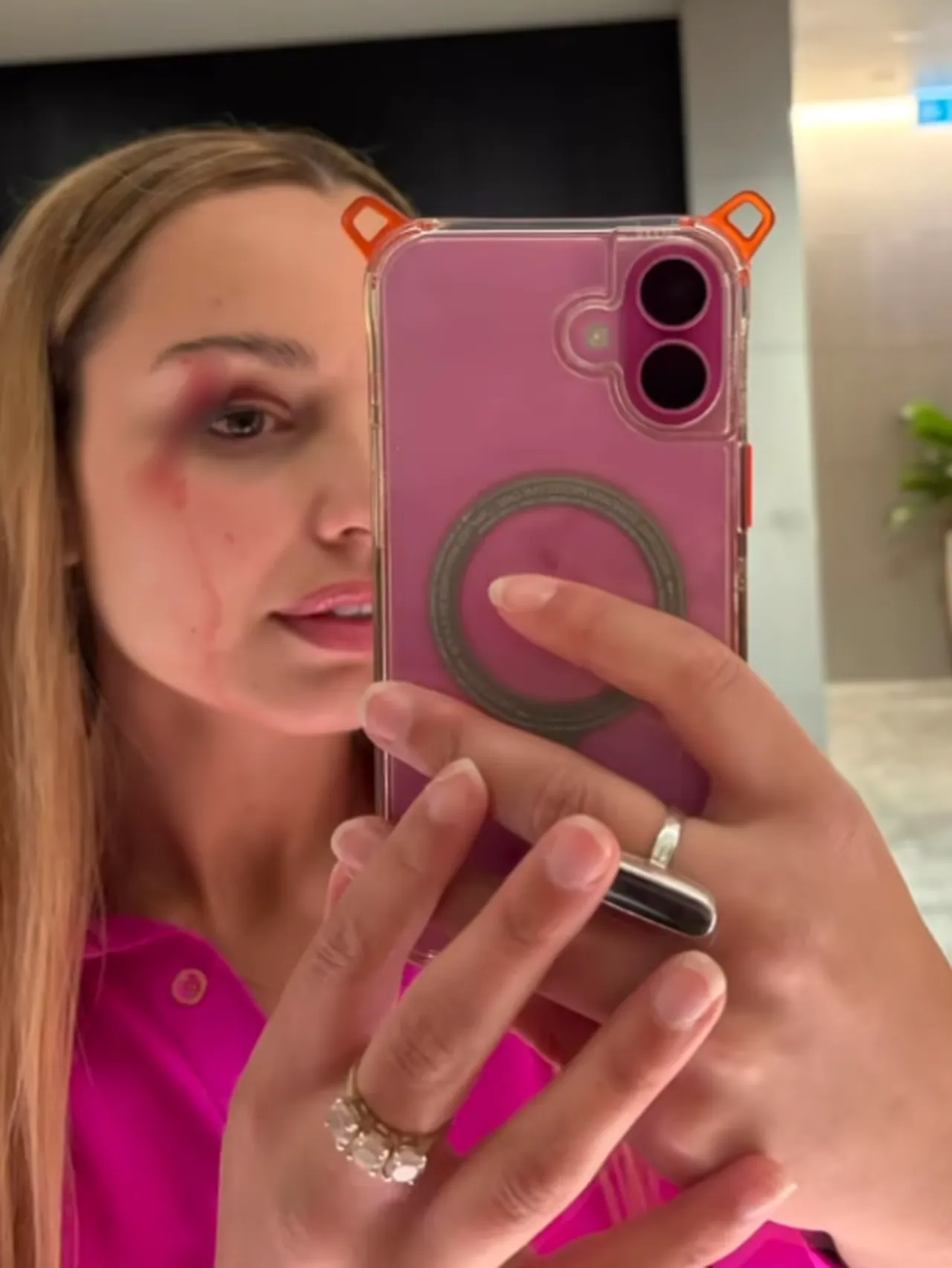 Canlı yayında martı saldırdı! Muhabir neye uğradığını şaşırdı