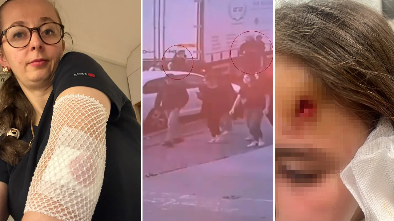 Ters yönden gelip kadınla çocuğa çarptılar! Arkalarına bakmadan kaçtılar