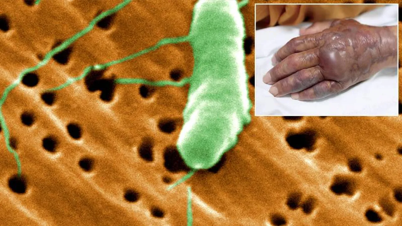 24 saat içinde öldüren enfeksiyon yayılıyor! Kırmızı leke diye geçmeyin