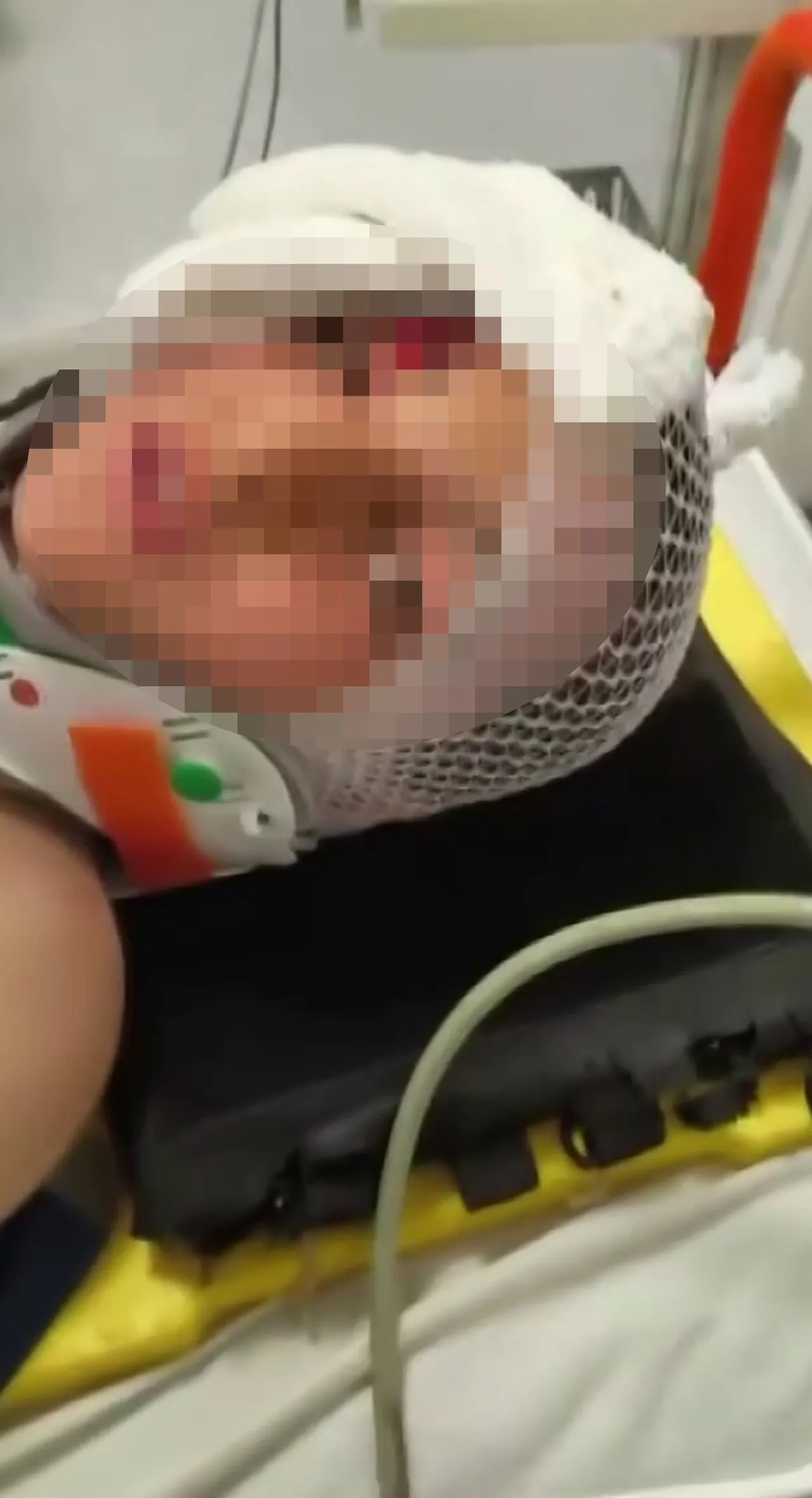 Taşların arasında sıkışarak yaralanan çocuk ameliyat oldu