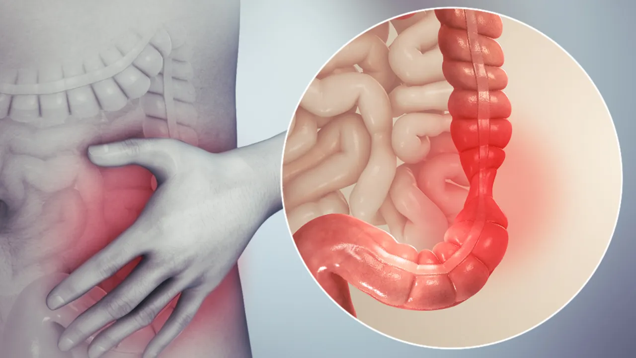 100 yaşını aşanların sırrı ortaya çıktı! Bağırsakta özel bakteriler keşfedildi