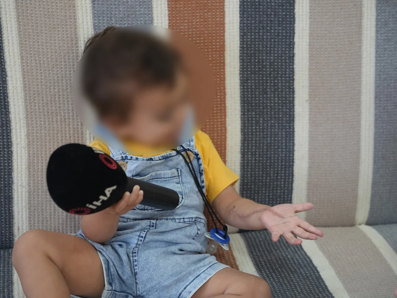 1,5 yaşındaki çocuğa ilaçlı tomografi çektiler, kolundan oldu! Aile şikayetçi oldu