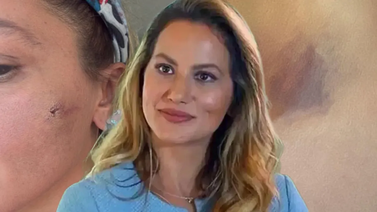 7 aylık eşinden şiddet gören Yıldız Asyalı yaşadıklarını anlattı: “Hastalıklı bir psikolojiye sahip”