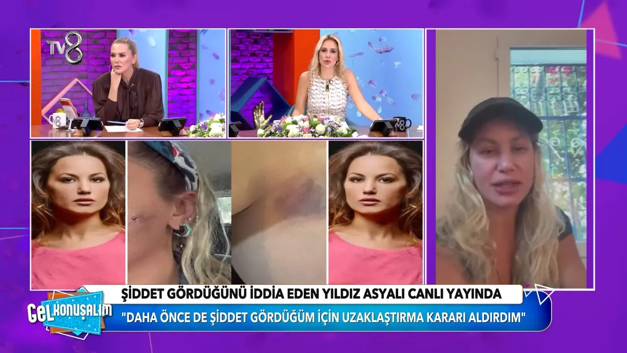 7 aylık eşinden şiddet gören Yıldız Asyalı yaşadıklarını anlattı! Semih Demirci'den cevap gecikmedi