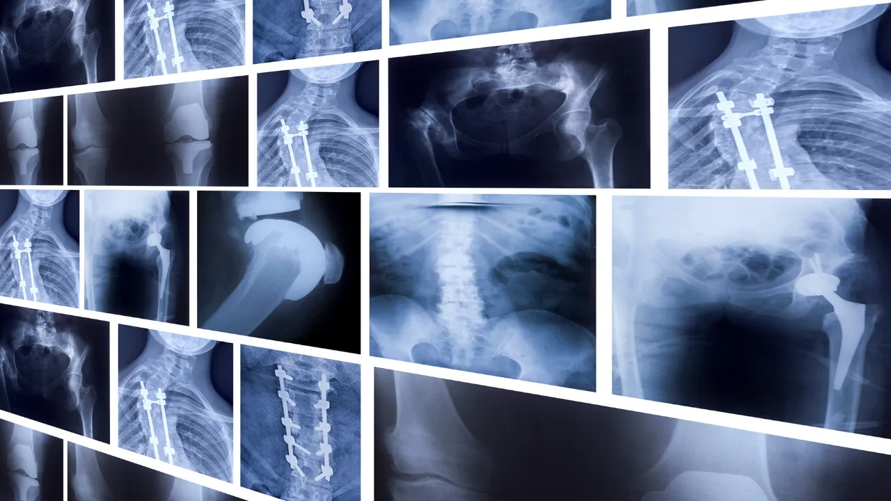 Basit bir eklem ağrısı sandı, gerçek hastanede ortaya çıktı! Aldığı teşhisle yıkıldı