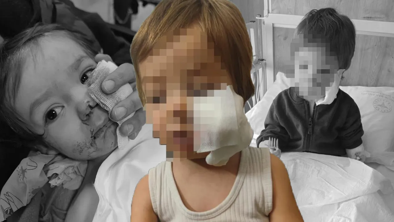 Pitbull dehşetinden kurtulan 1,5 yaşındaki Efe'den haber var: Kuduz riski... 