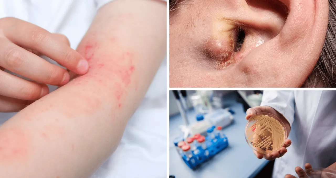 Deriye yapışıyor, ilaçlar işe yaramıyor! Ölümcül mantarın yayılma hızı arttı