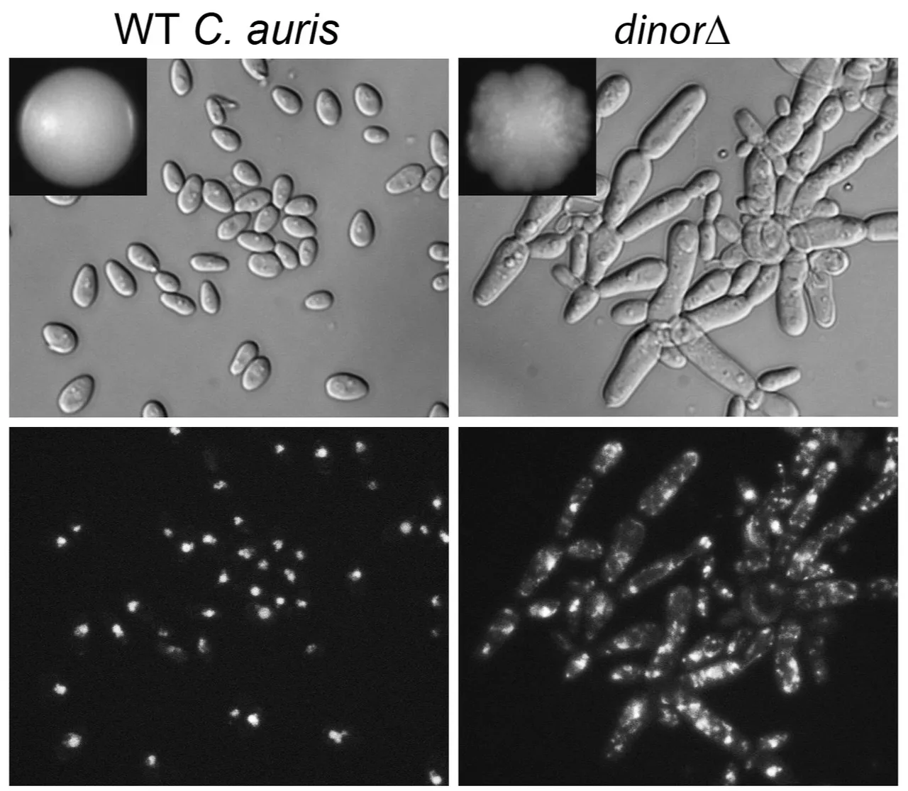 Ölüm oranı yüzde 50'den fazla! İlaçların etki etmediği mantarın vakaları hızla artıyor
