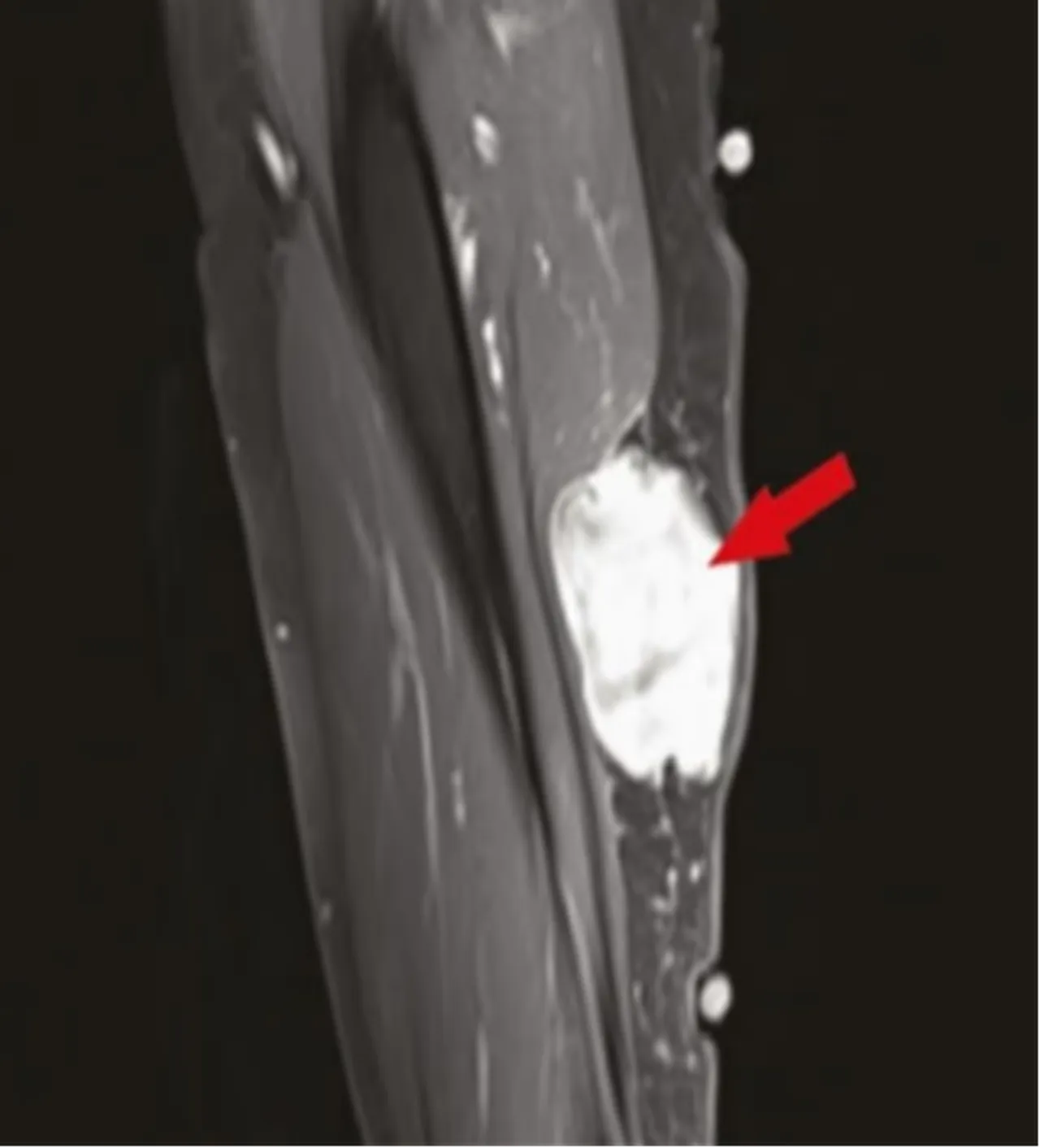 Bilim dünyası karıştı! Covid aşıları ile kanseri ilişkilendiren çalışmaya siber saldırı