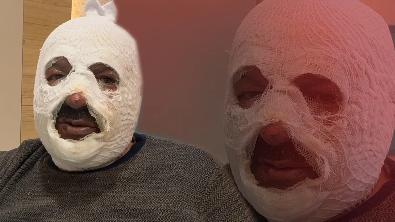  Ne yaptın sen Mehmet Amca! Arkadaşına yardım etmek isterken kabusu yaşadı