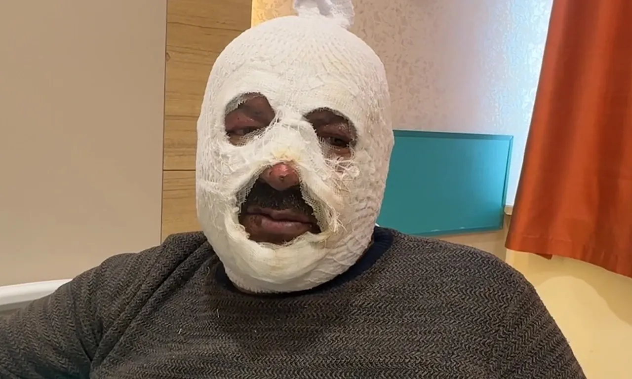 Ne yaptın sen Mehmet Amca! Arkadaşına yardım etmek isterken kabusu yaşadı