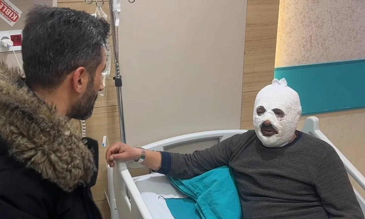 Ne yaptın sen Mehmet Amca! Arkadaşına yardım etmek isterken kabusu yaşadı