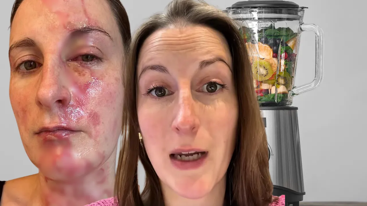 Görülmemiş blender faciası! Kapak fırladı, sıcak sos fışkırdı: Hastaneden korkutan açıklama