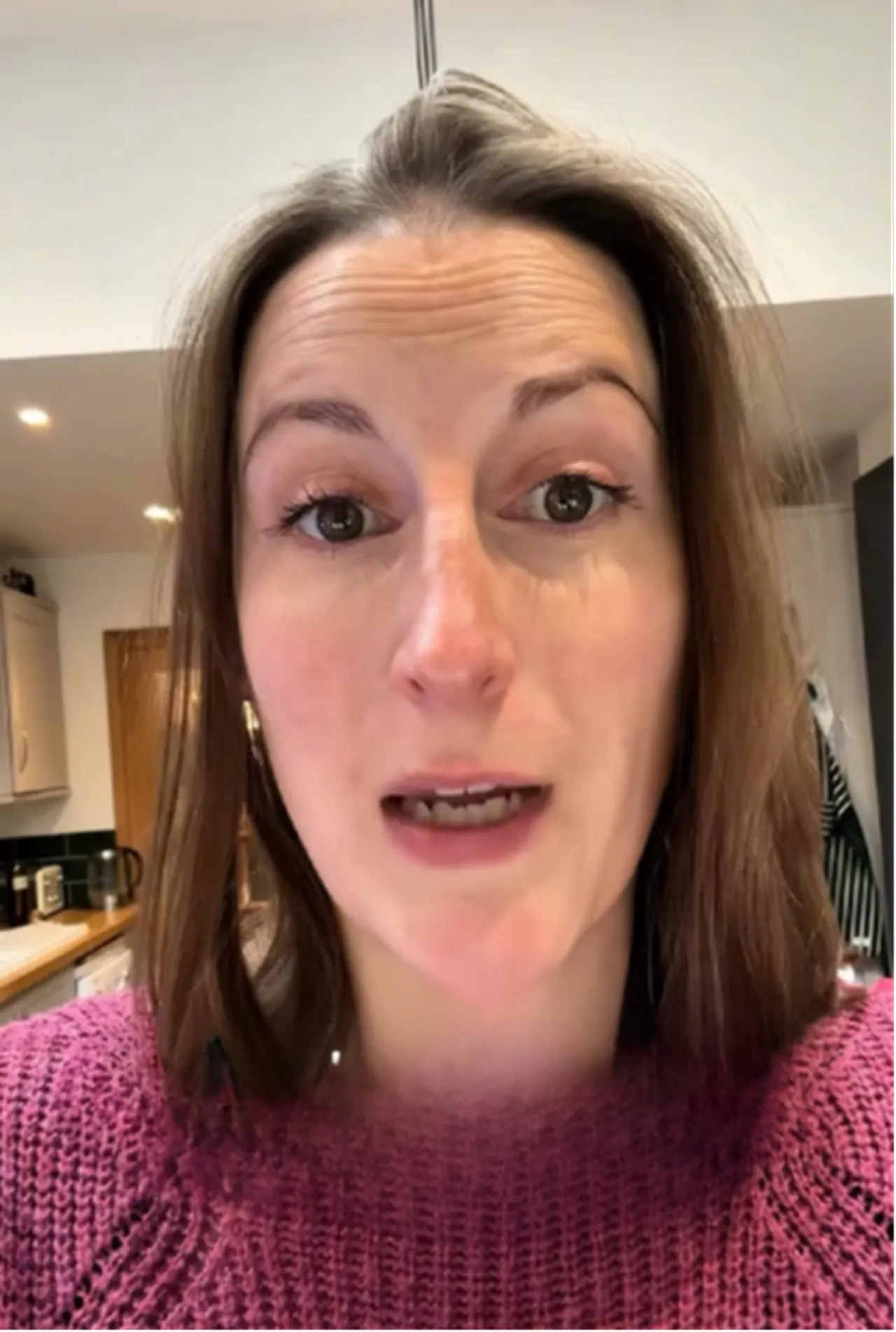 Görülmemiş blender faciası! Kapak fırladı, sıcak sos fışkırdı: Deri nakli gerekebilir