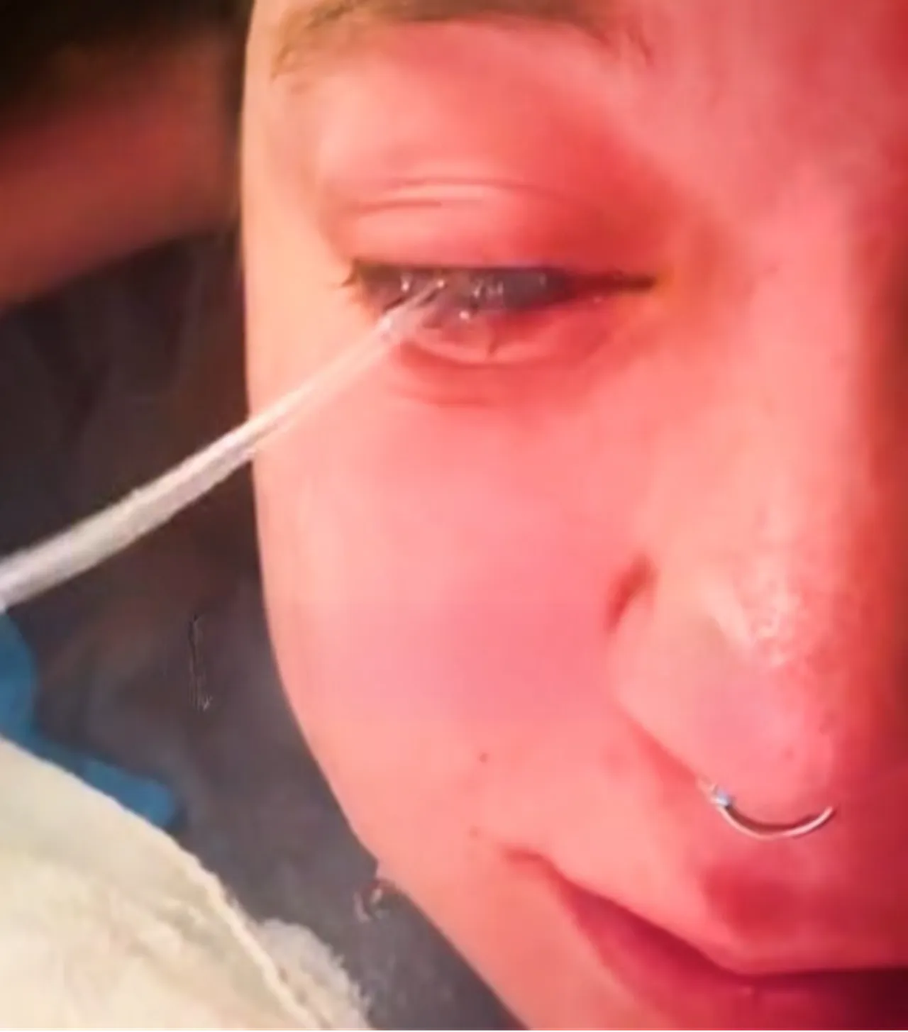 Sabah uyandı, neye uğradığını şaşırdı! Bir damla çamaşır suyu gözünden etti