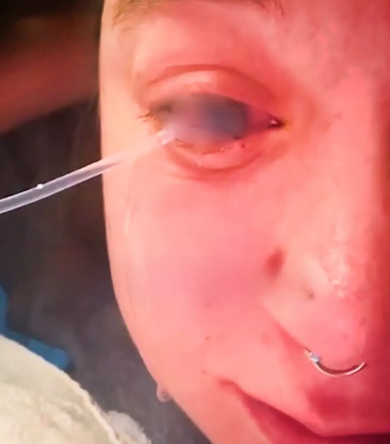 Sabah uyandı, neye uğradığını şaşırdı! Bir damla çamaşır suyu gözünden etti