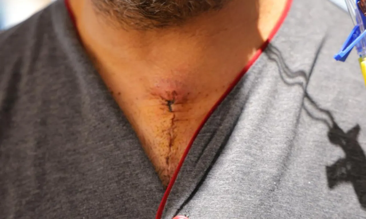 Göğüs ve sırt ağrısı şikayeti ölümle burun buruna getirdi! Nadir ameliyatla kurtuldu