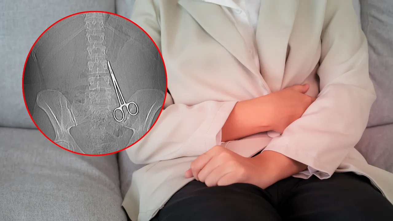 İhmalkarlığın böylesi! Ameliyatta unutulan makas genç kadını hayattan kopardı