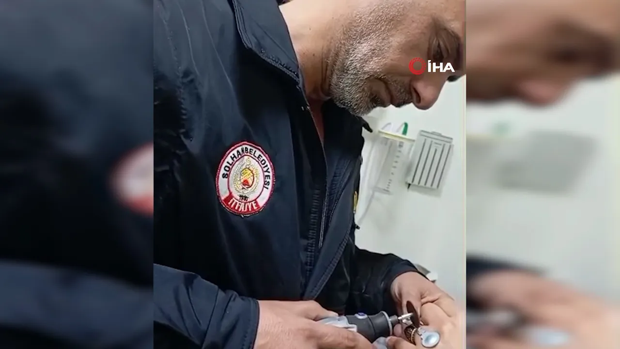 Hastanede itfaiyeden hassas müdahale! Sıkışan yüzük özel ekipmanla çıkarıldı