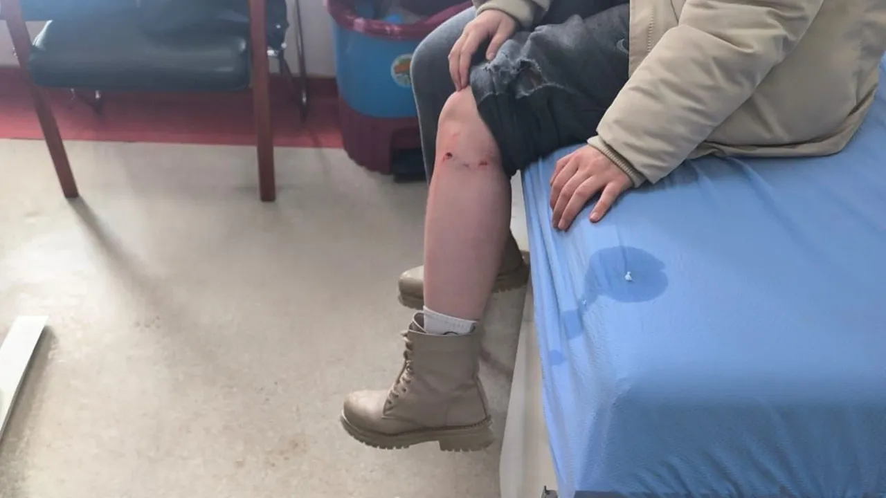 Kayseride dehşet anı! Sokak köpeği kız çocuğuna saldırdı