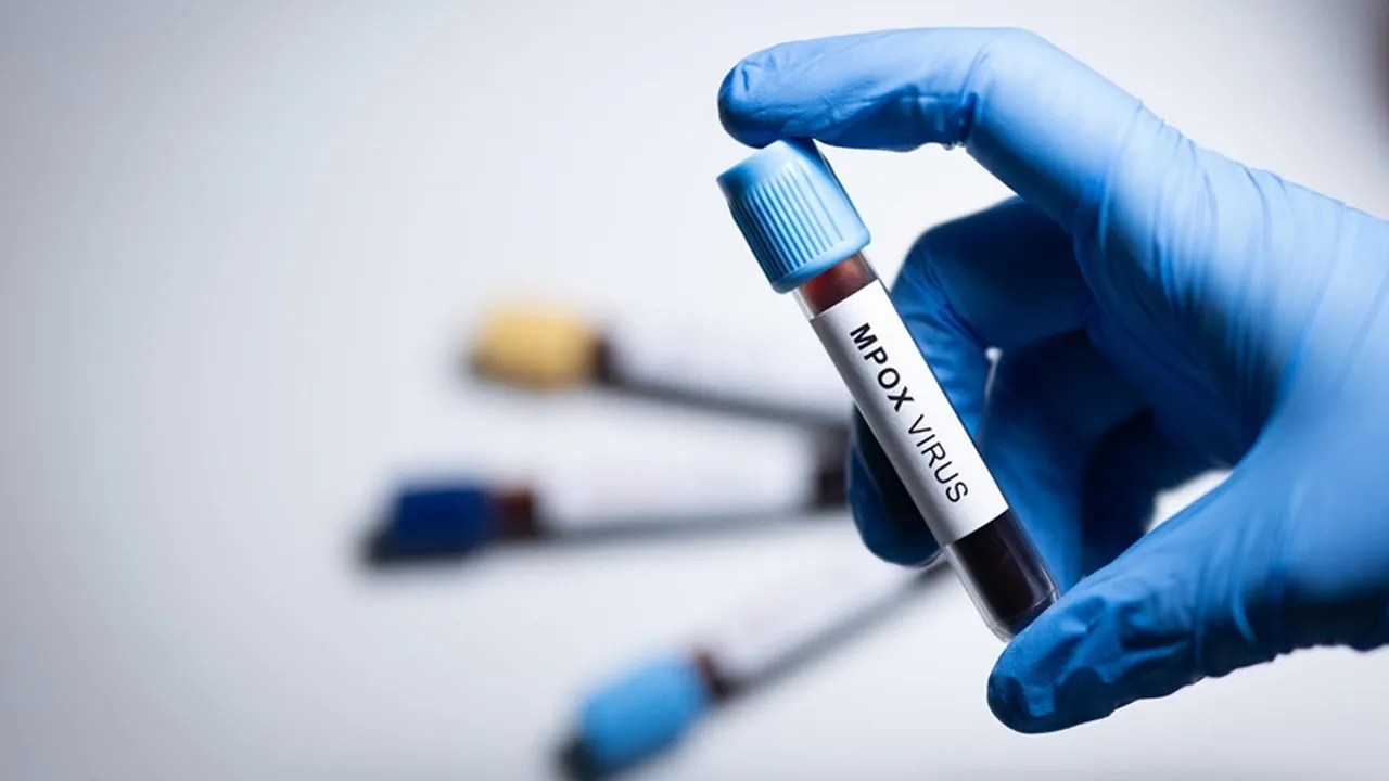 Madagaskar'da 'M çiçeği' alarmı: Vaka sayısı 78'e yükseldi