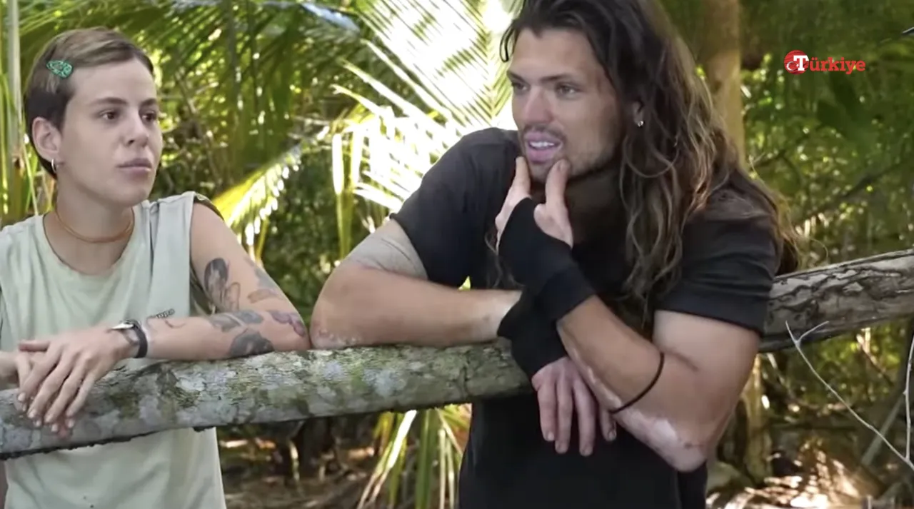 Survivor Onur Alp Çam’ın hastalığı (vitiligo) nedir, ellerinde ne var?