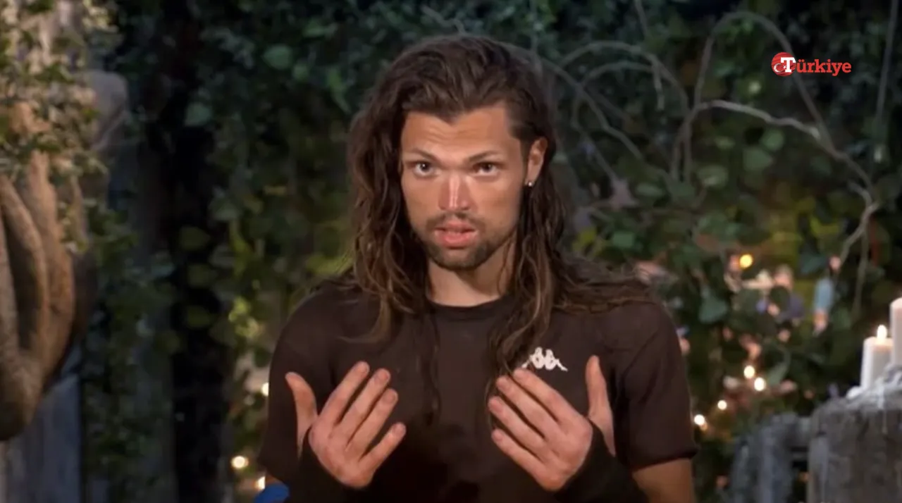 Survivor Onur Alp Çam’ın hastalığı (vitiligo) nedir, ellerinde ne var?