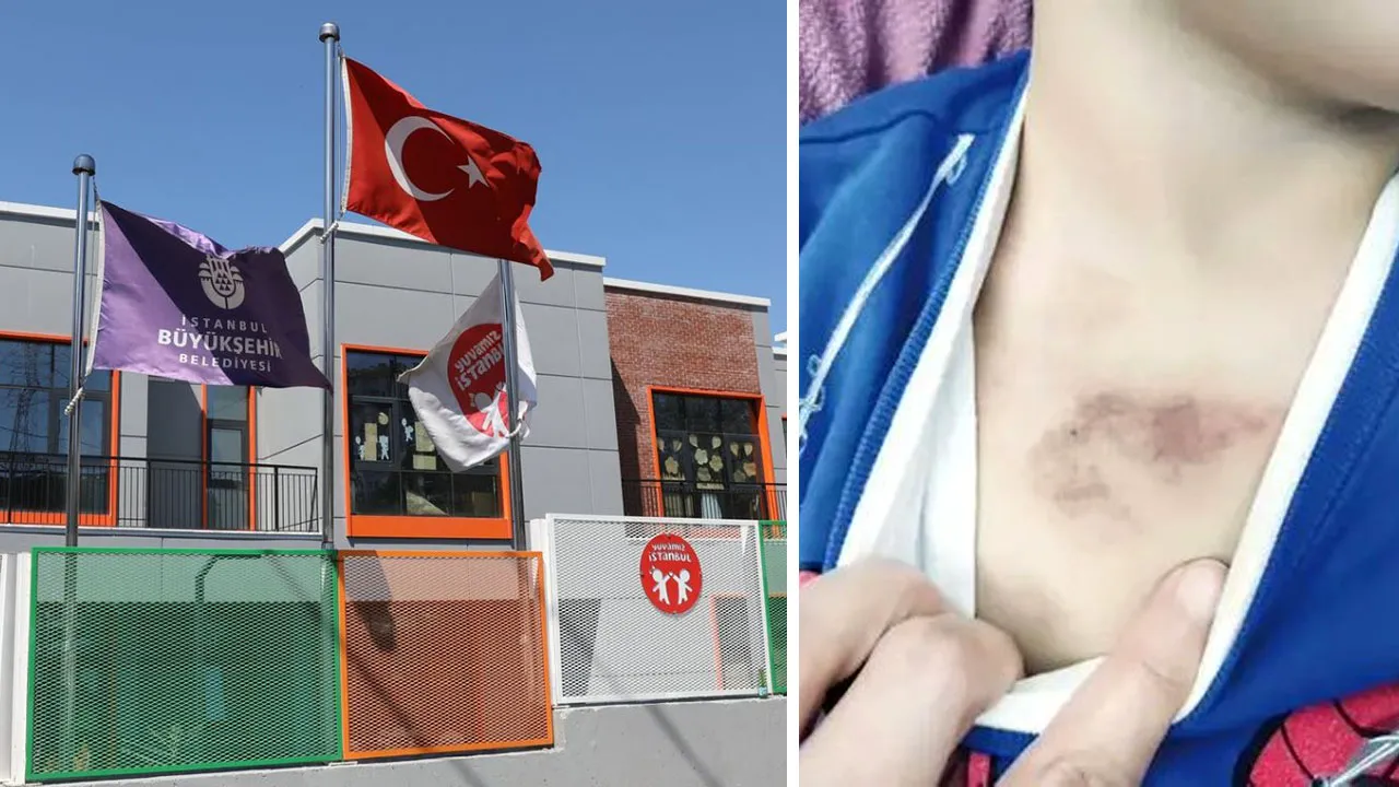 İBB kreşinde istismar ve darp iddiası! Çocuğun anlattıkları kan dondurdu: Soruşturma başlatıldı