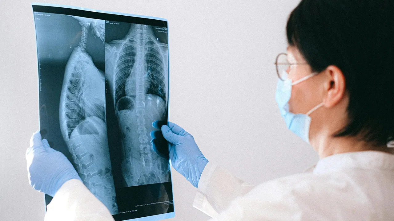 Geçmişte kalmadı! Uzmanlardan uyarı: Hala ciddi tehdit