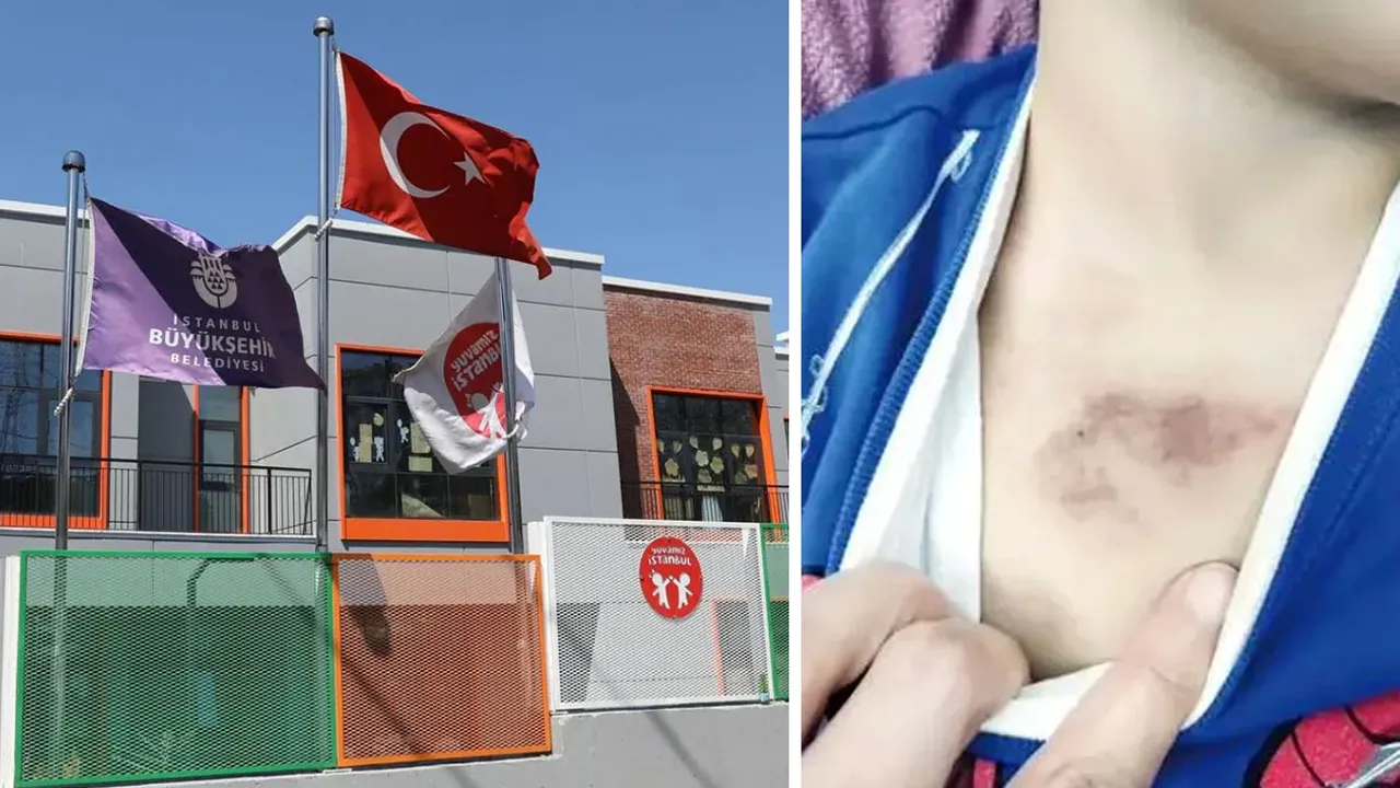 İBB kreşinde istismar ve darp iddiası! Bakan Göktaş, mağdur aileyi ziyaret etti: Personelin açığa alınmasını beklerdik
