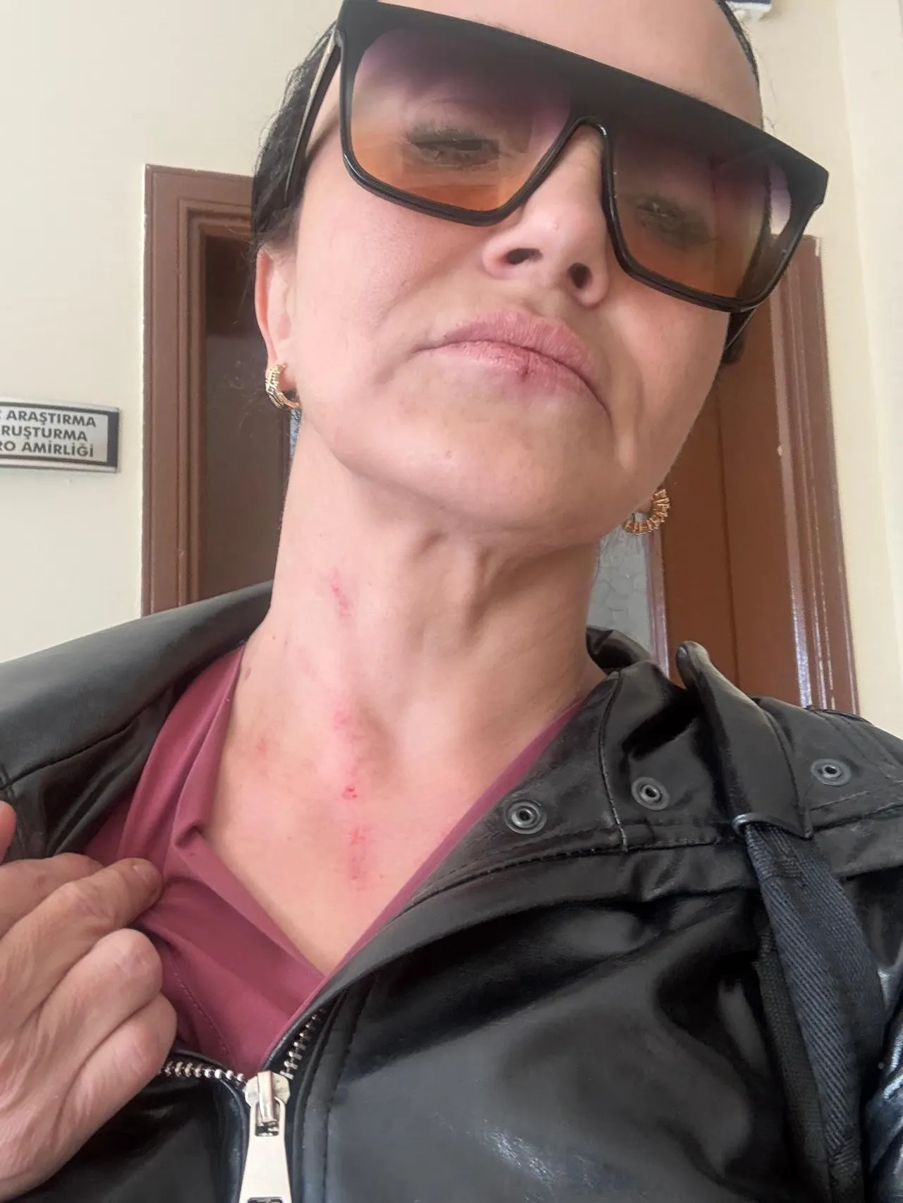 Zincirleme suçlara 1 aylık kelepçe! Boşanmak istedi, başına gelmeyen kalmadı