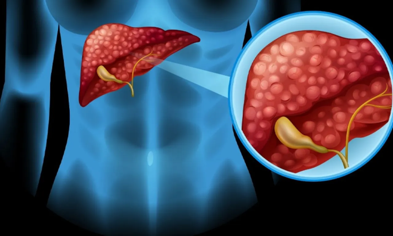 Günlük 2 tane yeterli! Karaciğeri ilk günkü gibi yapıyor