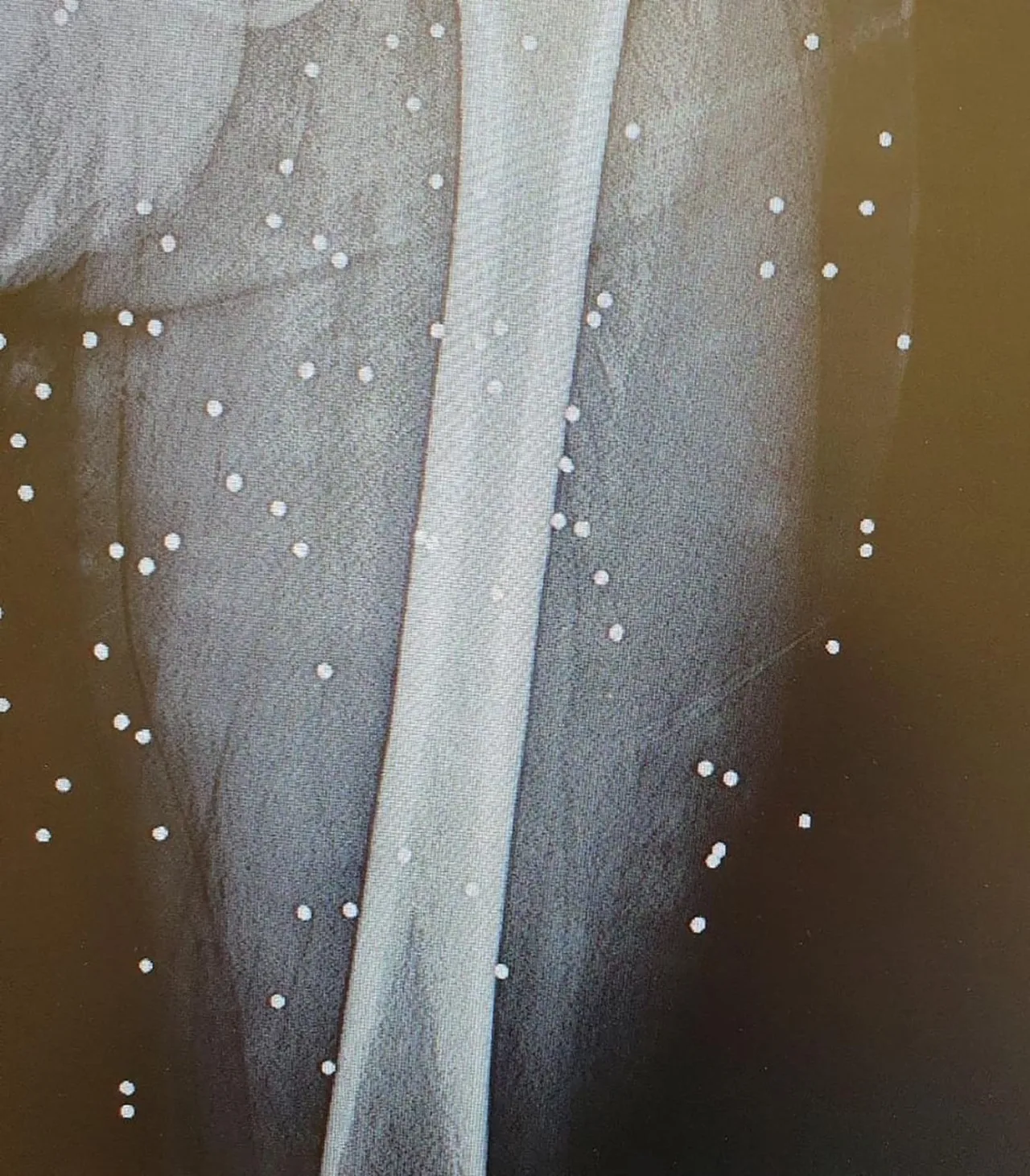 Tahran'da göstericilere ateş açılmasının ardından kalan saçmaları gösteren röntgen görüntüsü. Fotoğraf: Vahid Online