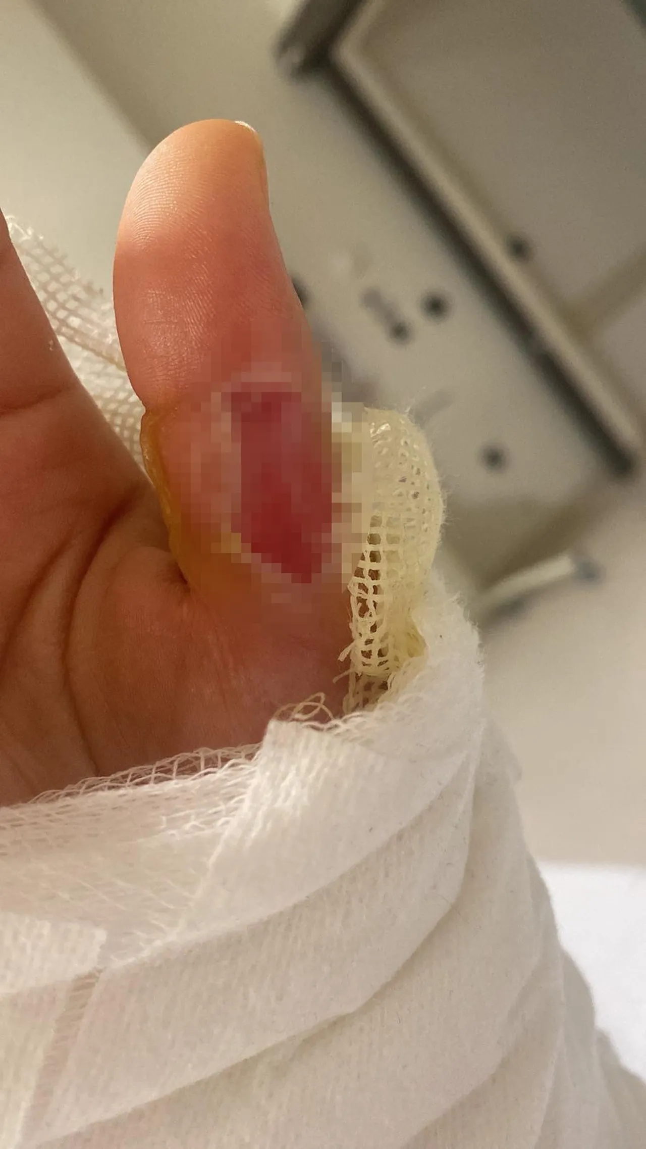 İstanbul’da son 2 ayda 3’üncü vaka! Herkes zararsız sanıyor ama her evde var