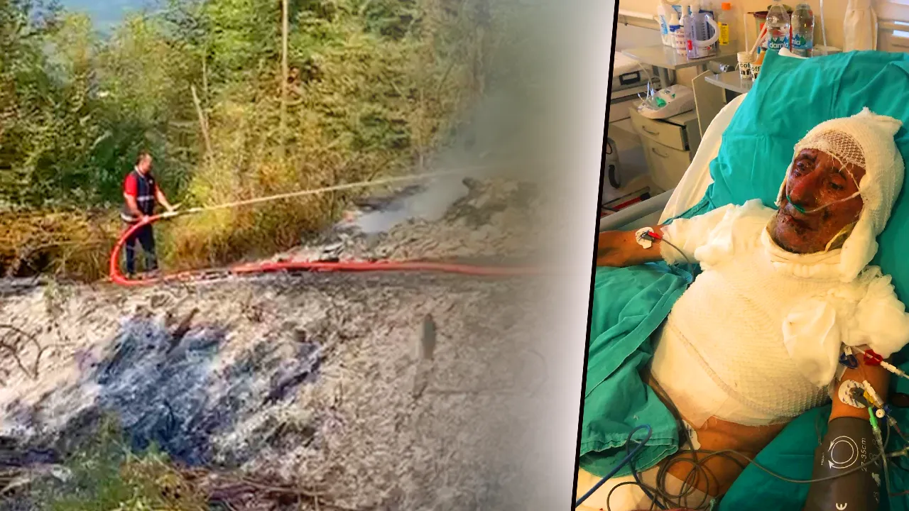 Ahırdaki dehşette kan donduran iddia: Kardeşim, beni benzin döküp yaktı