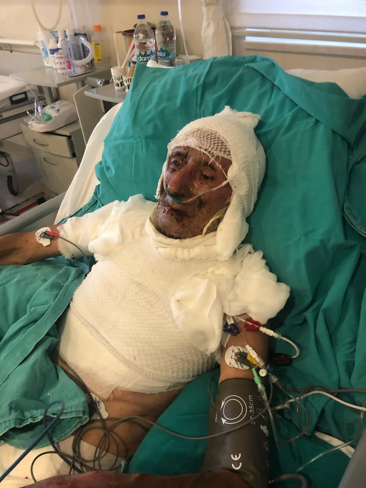 Ahırdaki dehşette kan donduran iddia: Kardeşim, beni benzin döküp yaktı