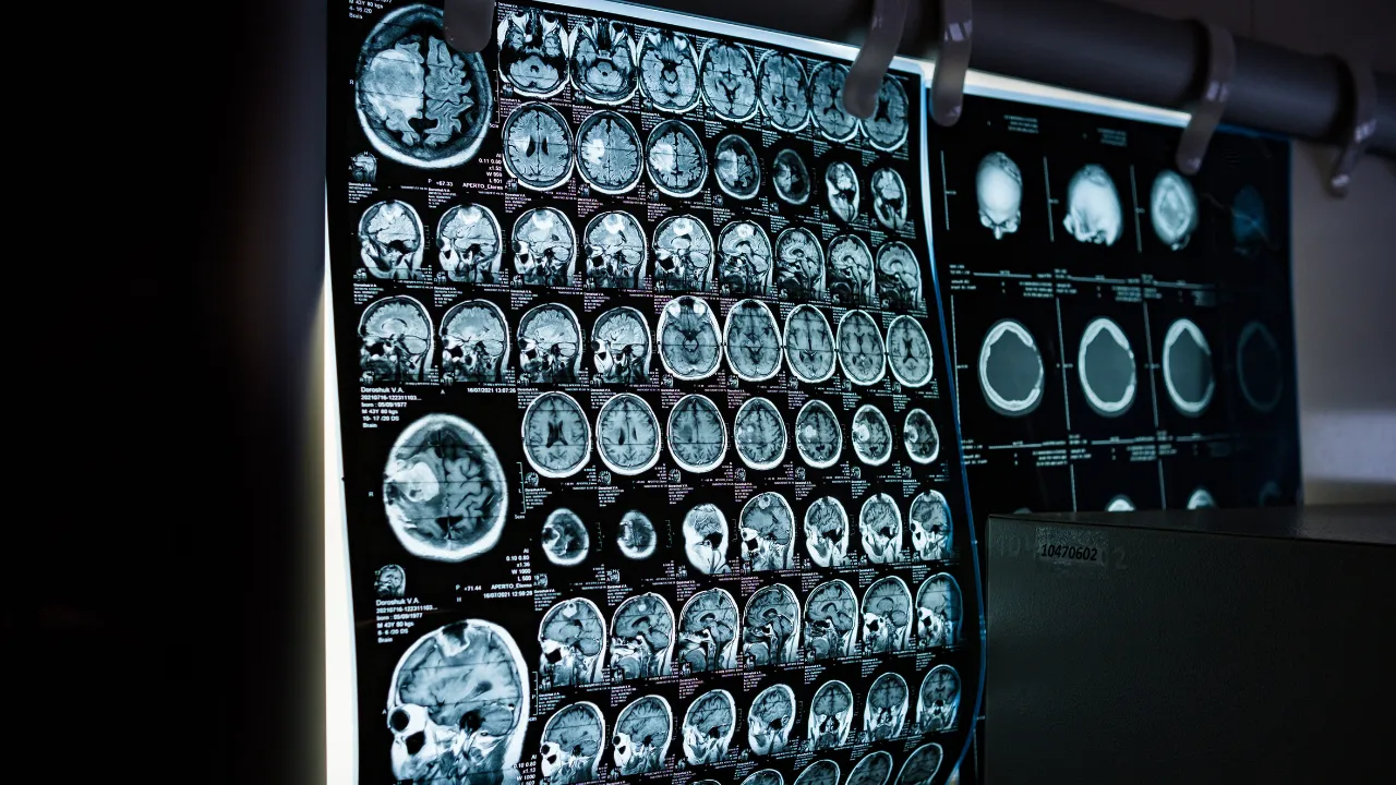 Doktorlar kulak tıkanıklığı sandı, gerçek bambaşka çıktı! 8 yaşındaki çocuk hayatını kaybetti