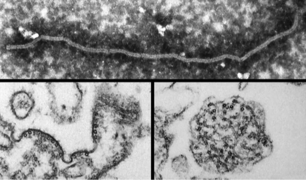 Nipah virüsü yeni bir pandemiye neden olabilir mi? Pek çok ülkede sınır kontrolleri geri geldi