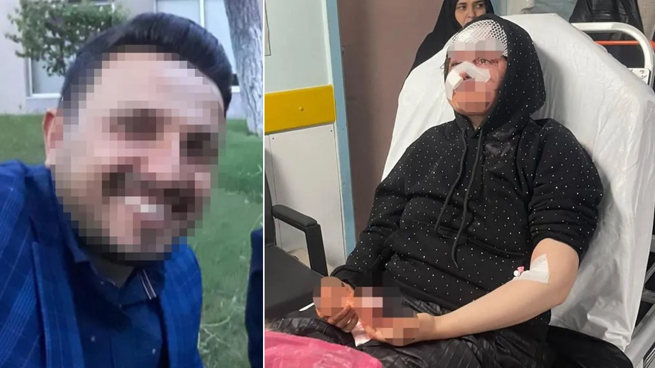 Boşanmak isteyen karısını öldüresiye dövdü! Saldırgan koca tutuklandı