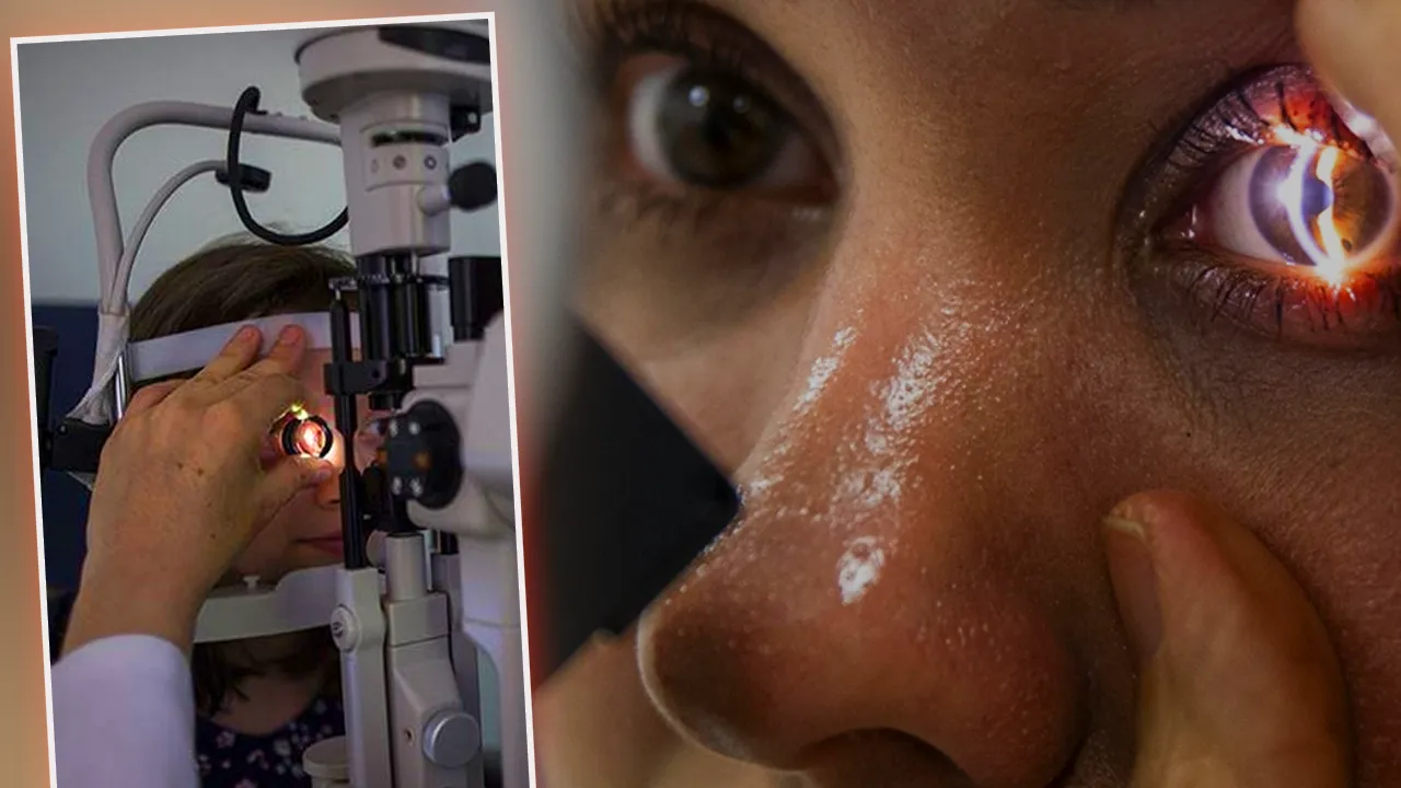 Herkes alerji sanıyor! Gözde sessiz tehlike: 8 bacaklı, 15 gün yaşıyor