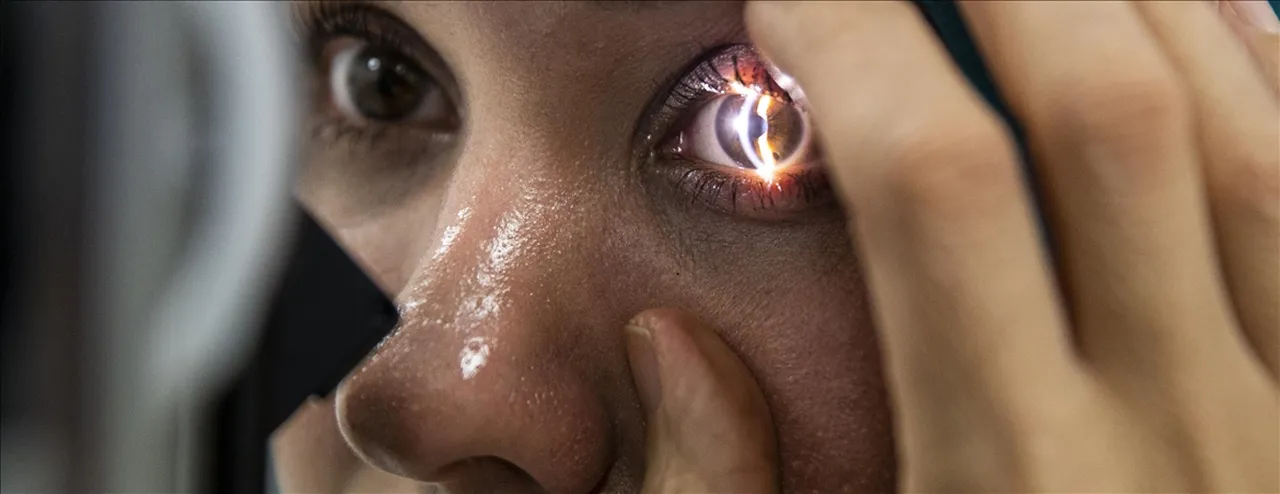 Herkes alerji sanıyor! Gözde sessiz tehlike: 8 bacaklı, 15 gün yaşıyor