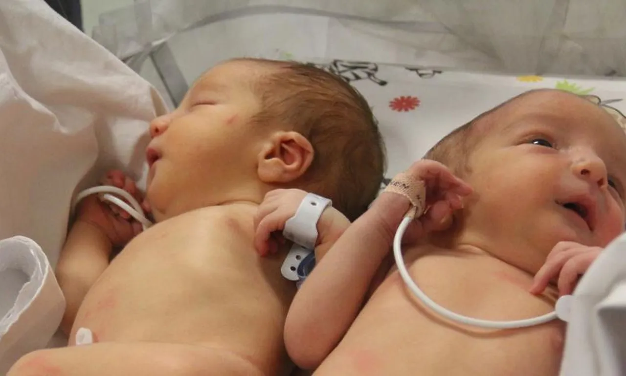 2019’da babalarını, depremde annelerini kaybetmişlerdi: Siyam ikizlerinden acı haber