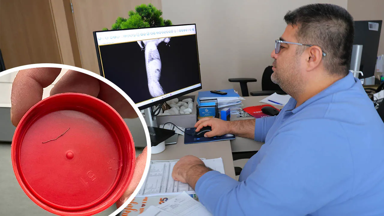 Böylesini ne gördük ne duyduk! 1 yaşındaki bebeğin sırtından zımba teli çıktı